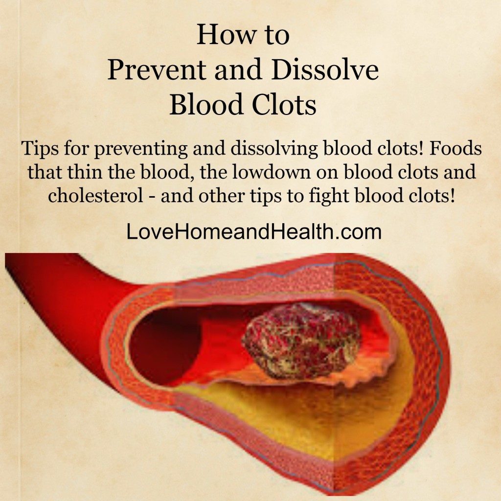 What Prevents Blood Clots In Connective Tissue At Deborah Staggs Blog