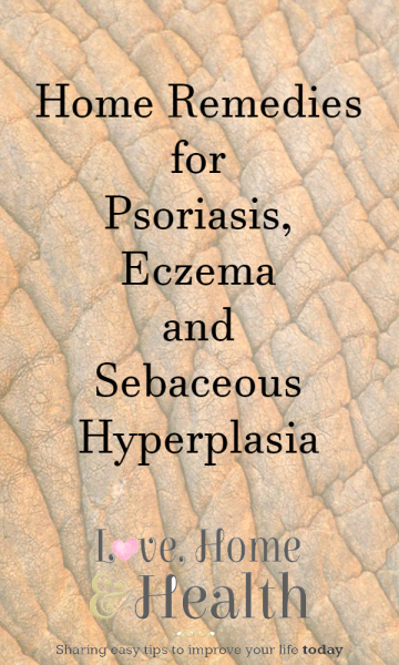 "Home remedies for Psoriasis, Eczema and Sebaceous Hyperplasia - Love, Home and Health"